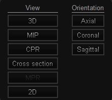 Επιλογές MPR