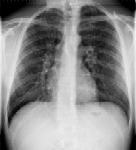 Ρύθμιση φωτεινότητας πολλαπλών κλιμάκων