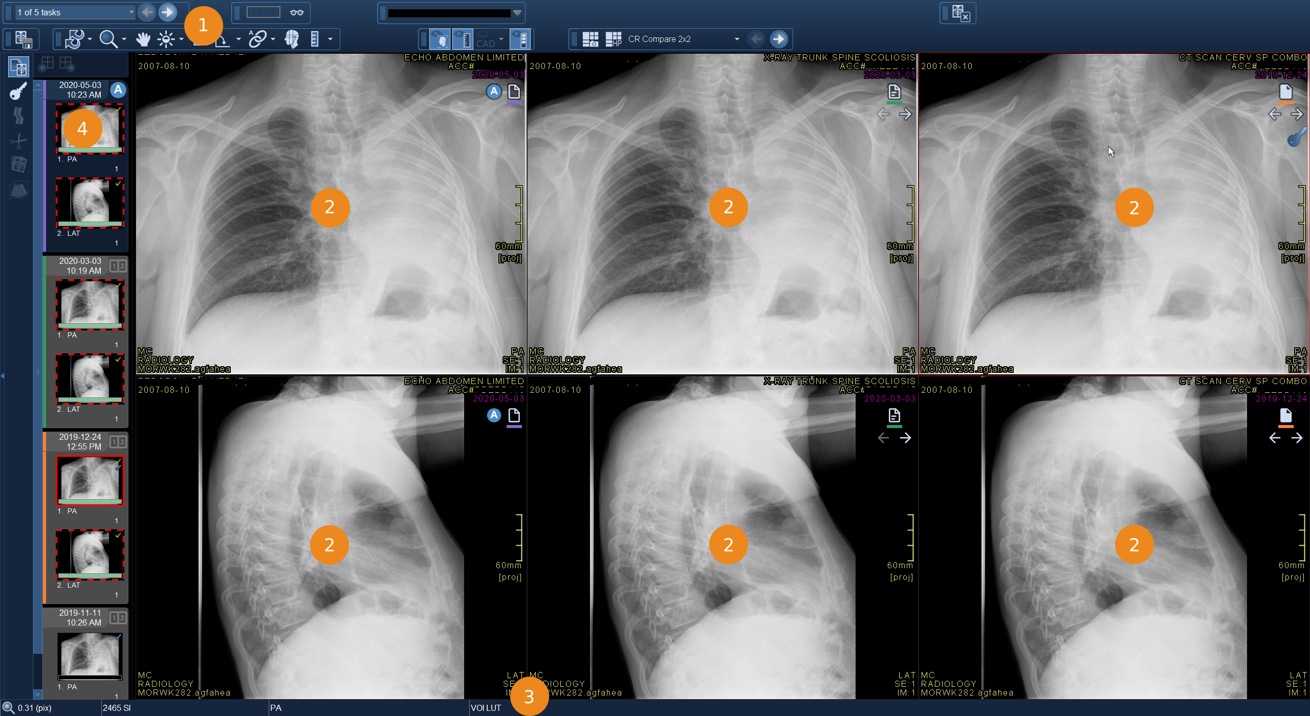 Περιοχή εικόνας με αριθμημένες επεξηγήσεις
