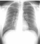 Συνήθης ρύθμιση φωτεινότητας