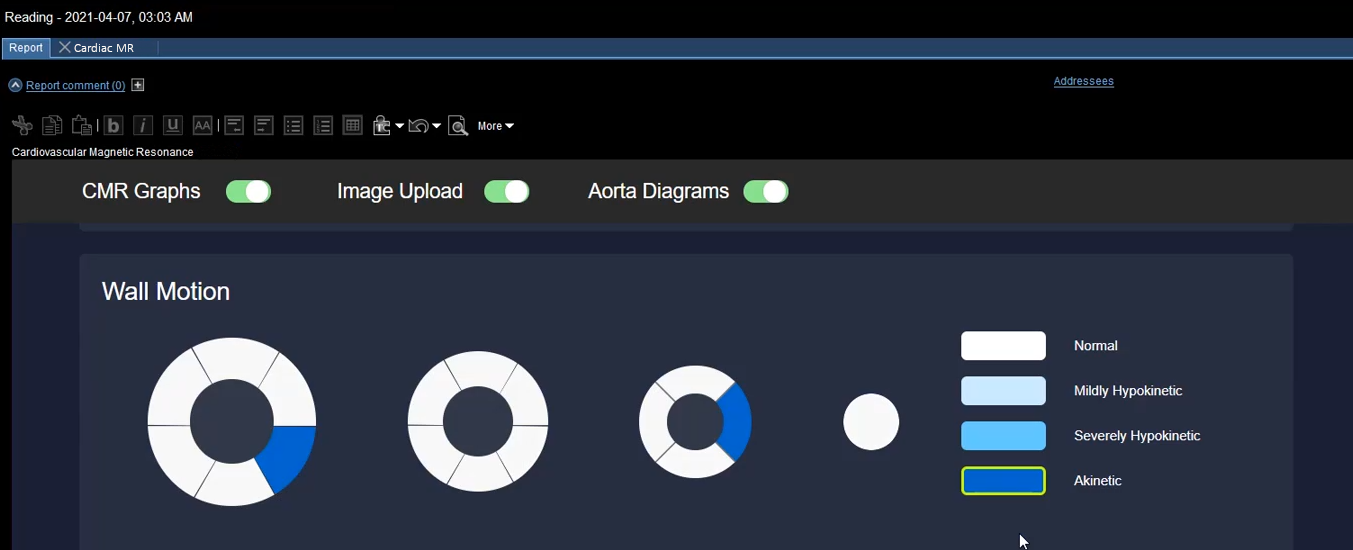 Παράδειγμα διαδραστικού διαγράμματος σε αναφορά ακριβείας.