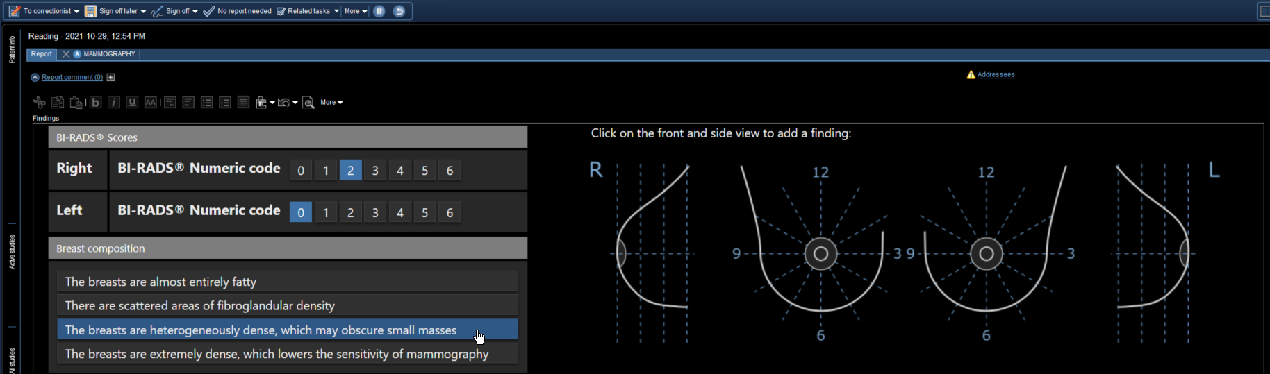 Περιοχή κειμένου που εμφανίζει την αναφορά ακριβείας για μαστογραφία.