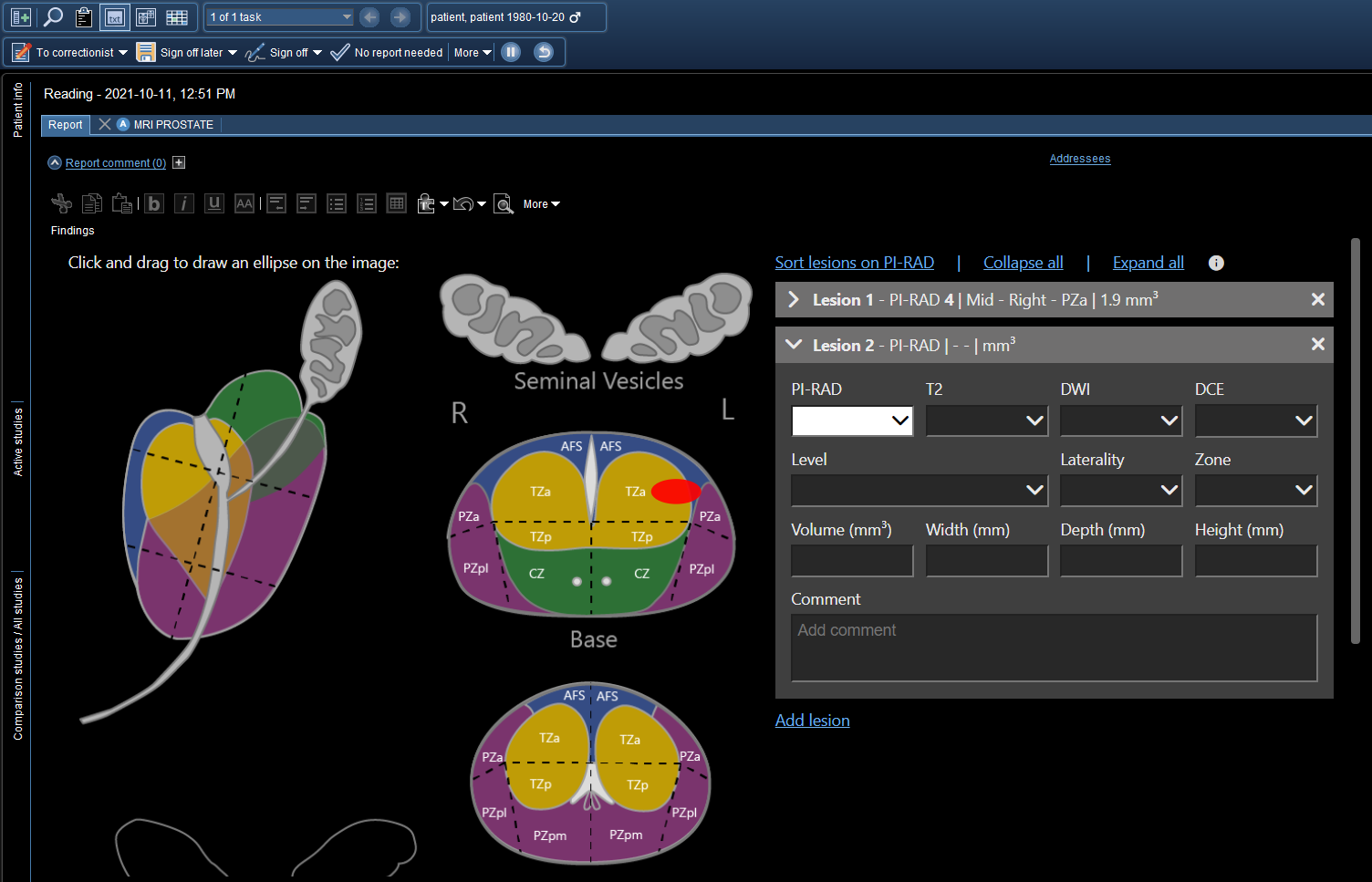 Παράδειγμα αναφοράς ακριβείας PI-RAD στην περιοχή κειμένου.