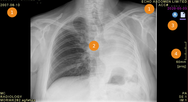 Παράθυρο με αριθμημένες επεξηγήσεις