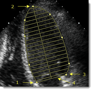 Μετρήσεις όγκου κοιλότητας