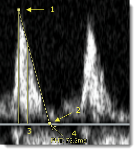 Μετρήσεις χρόνου ημίσειας πίεσης
