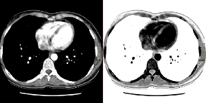 Ανεστραμμένη εικόνα