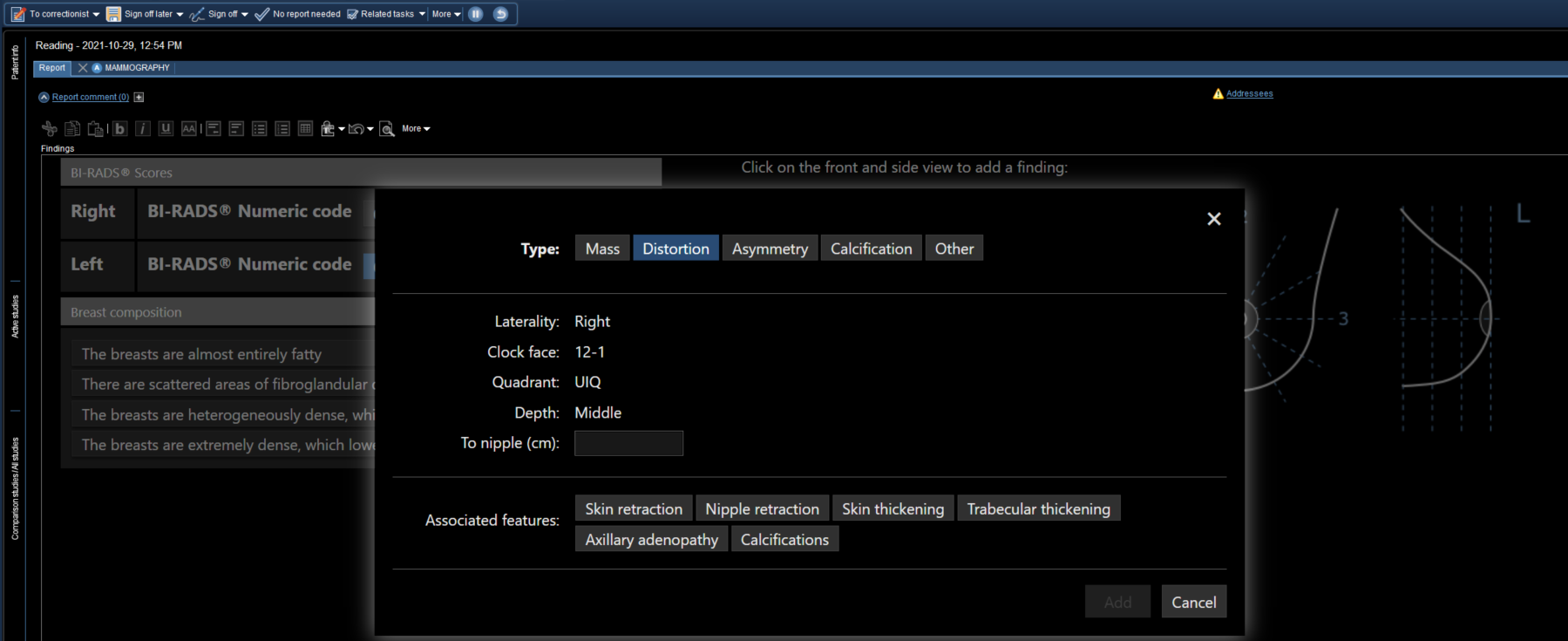 Επιλογές παραμόρφωσης στην αναφορά ακριβείας.