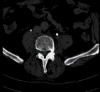 Έγινε ρύθμιση στη φωτεινότητα/αντίθεση της αρχικής εικόνας