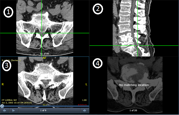 Παράδειγμα τεσσάρων σειρών με χρήση της λειτουργίας ενεργού στόχου