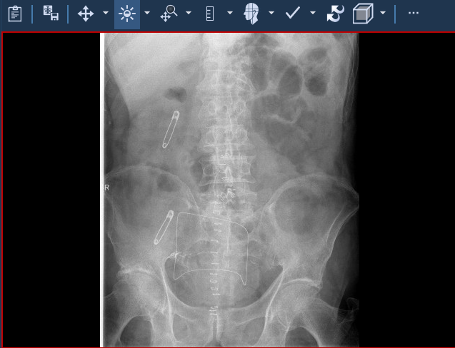 Εξέταση ασθενούς όπου αποκρύπτονται οι δημογραφικές πληροφορίες