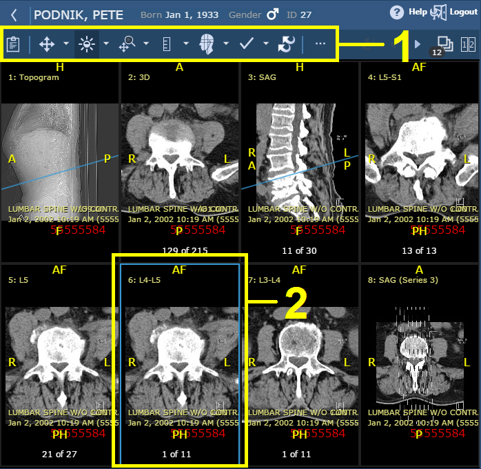 Εξέταση ασθενούς στην περιοχή εμφάνισης με επεξηγήσεις που περιγράφουν τη γραμμή εργαλείων της περιοχής εικόνας και το ενεργό παράθυρο