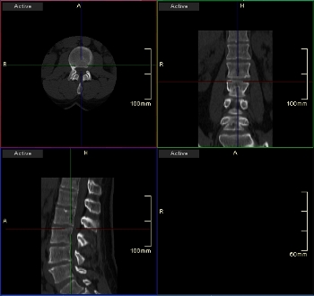Προεπιλεγμένη διάταξη