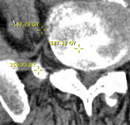 Εικόνα που δείχνει μετρήσεις πυκνότητας pixel