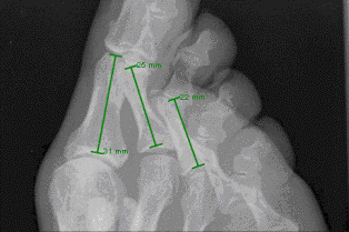 Σήμανση σε μια εικόνα