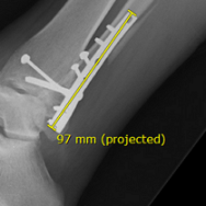 Σήμανση σε μια εικόνα με ετικέτα μέτρησης Προβλεπόμενη