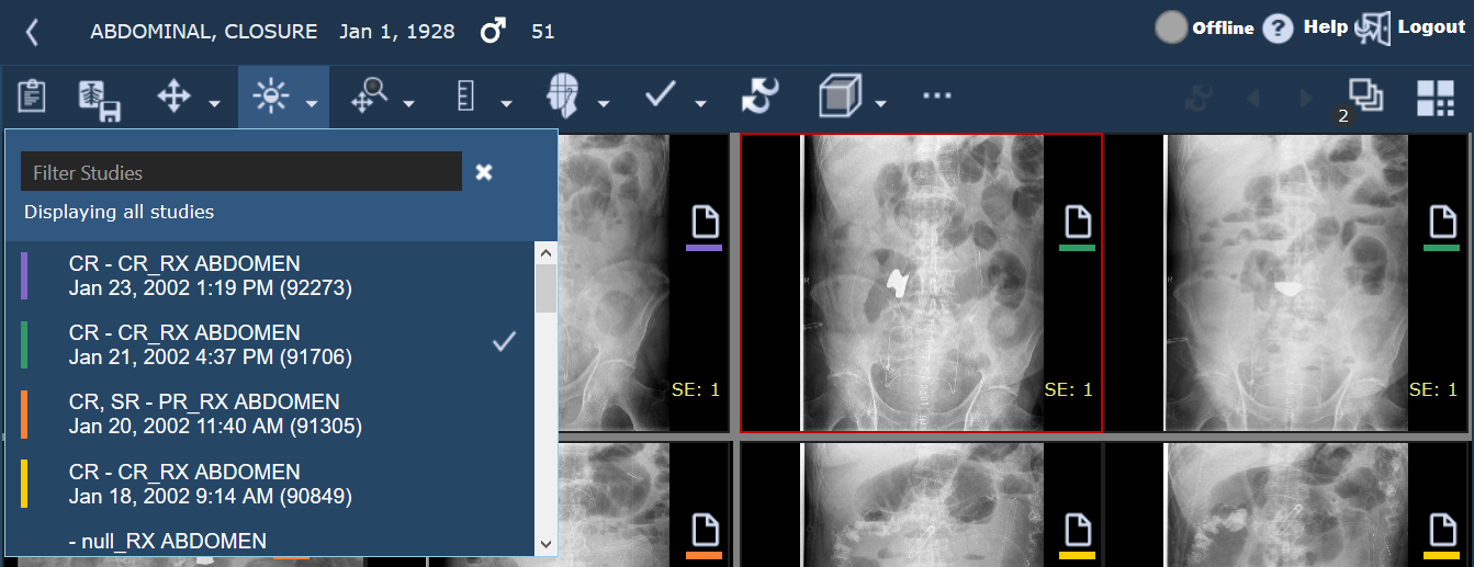 Εμφάνιση σήμανσης εξέτασης