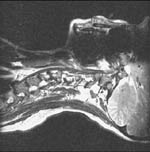 Η αρχική εικόνα έχει περιστραφεί κατά 90 μοίρες