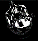 Πιο σκούρα εικόνα