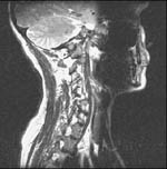 Η αρχική εικόνα έχει αναστραφεί οριζόντια
