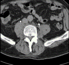 Αρχική εικόνα