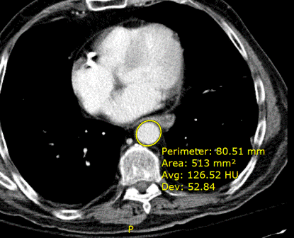 Εικόνα με σήμανση έλλειψης