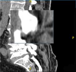 Αρχική εικόνα με μεγεθυντικό φακό