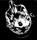 Αρχική εικόνα