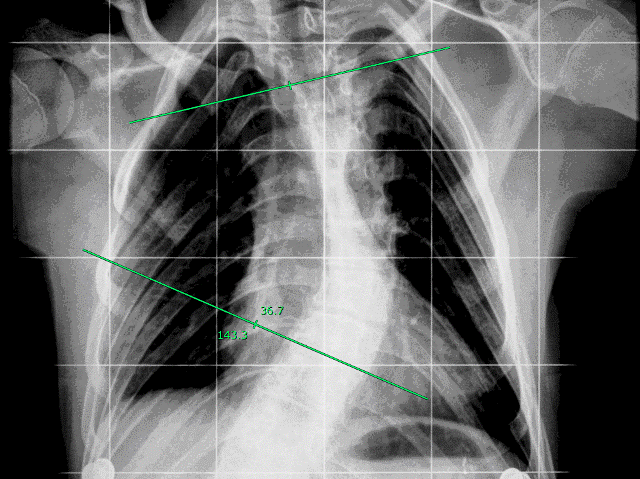 Εικόνα με σήμανση χρησιμοποιώντας το εργαλείο μέτρησης γωνίας