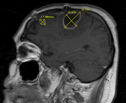 εικόνα εξέτασης με σημάνσεις ακτινολόγου