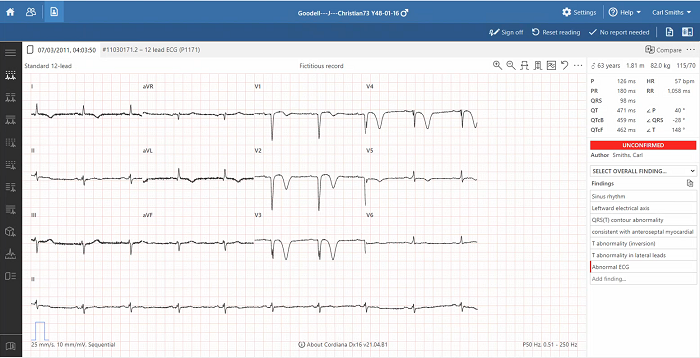 Εξέταση ΗΚΓ