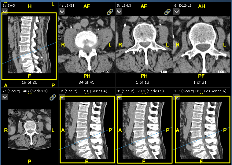 Παράδειγμα εξέτασης με τέσσερις σειρές με κοινό πλαίσιο αναφοράς