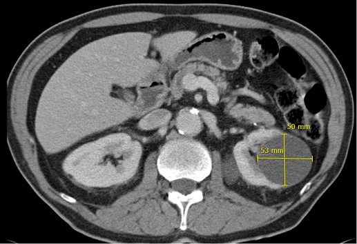 εικόνα εξέτασης με σημάνσεις ακτινολόγου