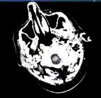 Έγινε αύξηση της φωτεινότητα της αρχικής εικόνας